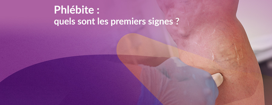 Phlébite : quels sont les premiers signes ?